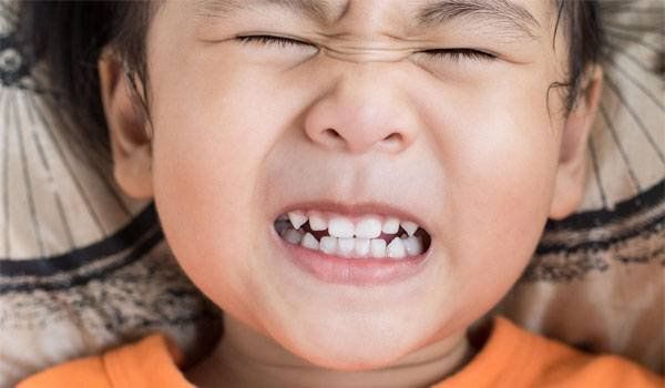 Hậu quả nghiến răng ken két khi ngủ: Rụng răng, biến dạng khớp hàm