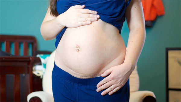 Béo bụng sau sinh do nội tiết... biết được lí do sẽ giảm mỡ dễ dàng