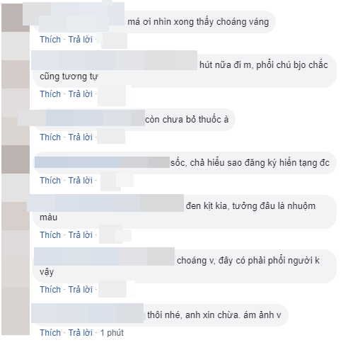Lá phổi đen của người đàn ông 52 tuổi qua đời sau 30 năm hút thuốc lá