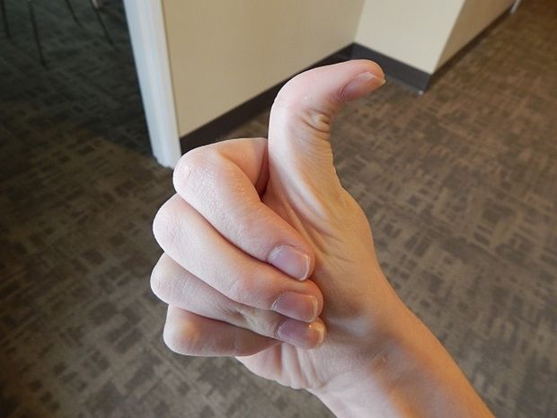 Lưỡi chạm mũi, có lúm đồng tiền... là bạn đã thuộc hàng hiếm trên TG