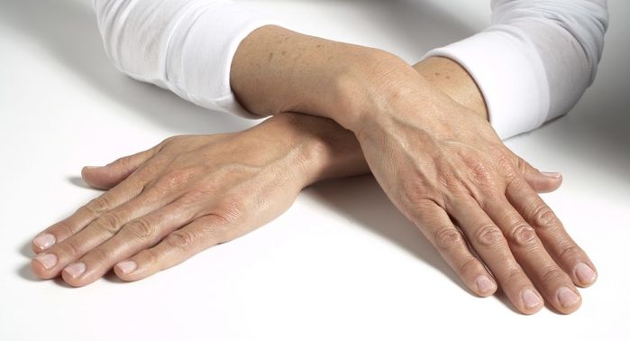 Tay khô hoặc phát lực yếu khi bắt tay là dấu hiệu sức khỏe cần lưu ý