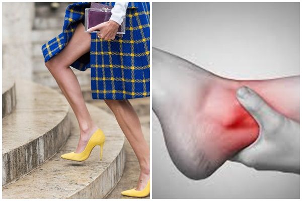 Hiệp hội Y tế Hoa Kỳ: Thường mang giày cao gót giảm khả năng thụ thai