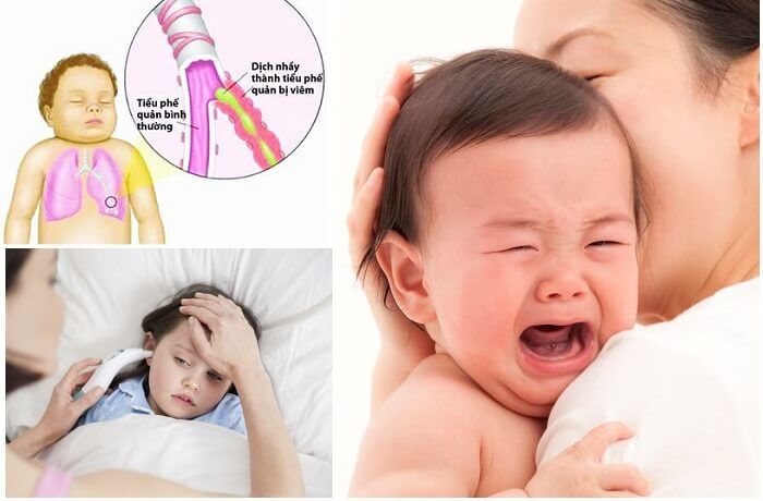 5 vấn đề sức khỏe năm 2019, đáng sợ nhất là vi khuẩn ăn thịt người