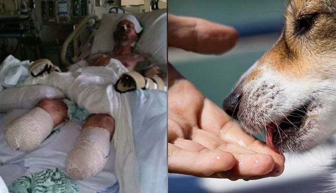 Cụ ông 63 tuổi nhiễm trùng dẫn đến thiệt mạng chỉ vì bị thú cưng liếm