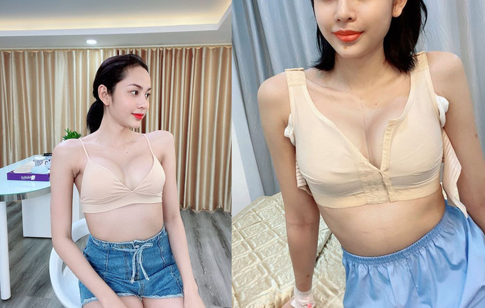 Sau Hương Giang, Lương Trung Kiên là ca chuyển giới thành công gây sốt
