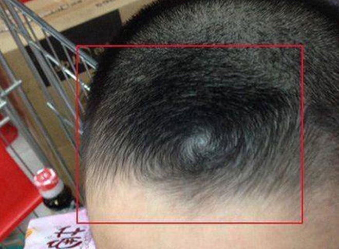 Theo Nhân tướng học: Sở hữu 2 xoáy là mẫu người yêu cực lý tưởng