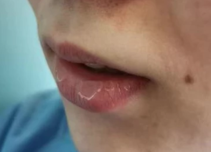 Bác sĩ BV Vũ Hán tiết lộ sau việc sau khi cởi đồ bảo hộ: Uống nước!