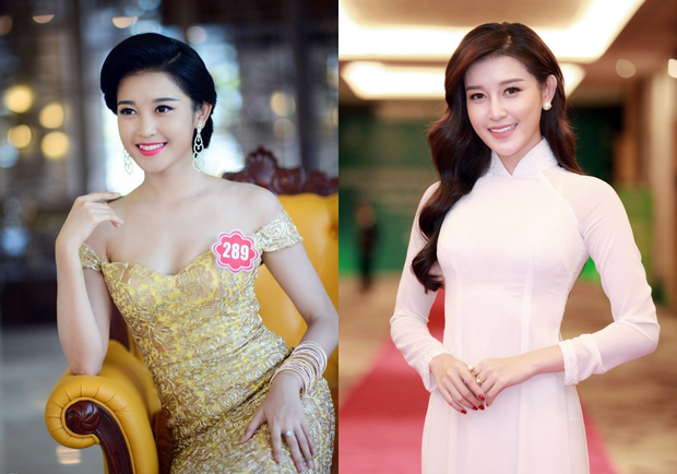 Sao Việt làm răng: Minh Hằng bị răng thưa, Ngọc Hân răng khấp khểnh