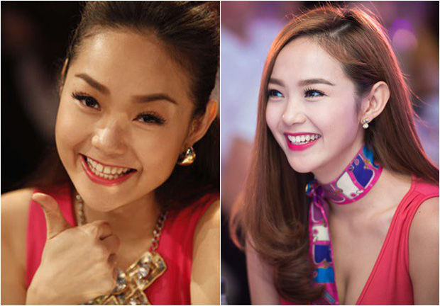 Sao Việt làm răng: Minh Hằng bị răng thưa, Ngọc Hân răng khấp khểnh