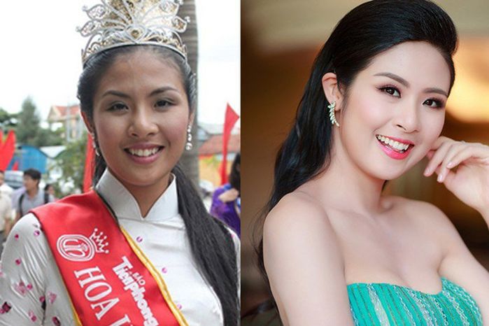 Sao Việt làm răng: Minh Hằng bị răng thưa, Ngọc Hân răng khấp khểnh