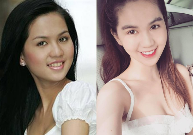 Sao Việt làm răng: Minh Hằng bị răng thưa, Ngọc Hân răng khấp khểnh