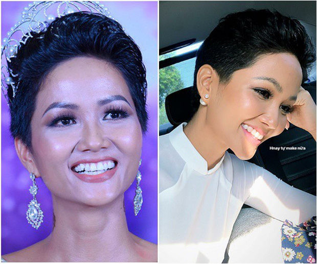 Sao Việt làm răng: Minh Hằng bị răng thưa, Ngọc Hân răng khấp khểnh