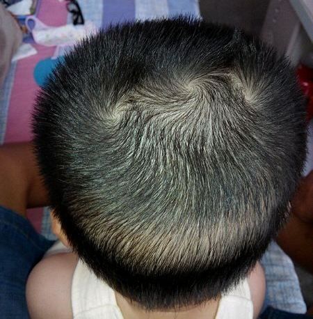 Nhìn xoáy tóc biết vận mệnh trẻ có 2 xoáy đầu thường nghịch ngợm tài giỏi  hơn người