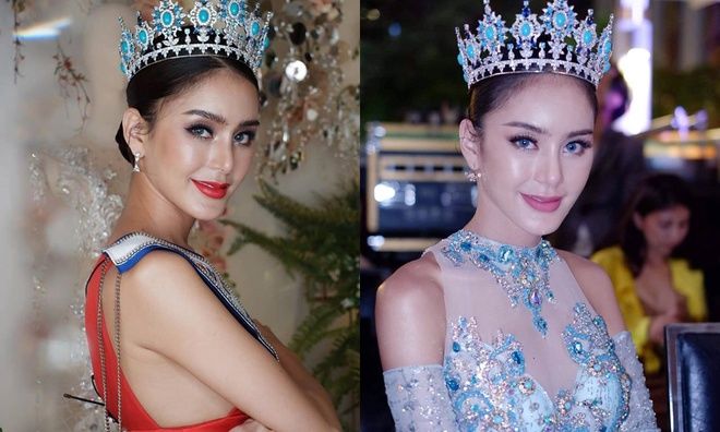 Hoa hậu Chuyển giới Thái Lan phẫu thuật để trở lại là nam giới