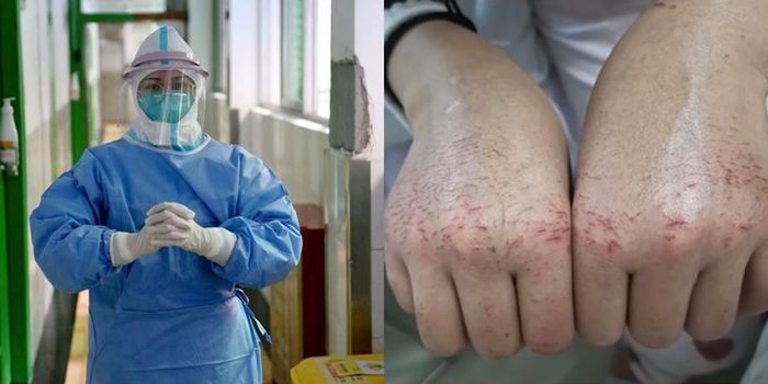 Nữ y tá hỗ trợ Vũ Hán giữa dịch Corona: Làm liên tục từ đêm giao thừa
