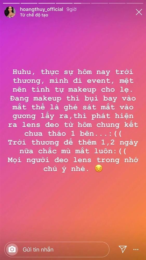 Sự cố làm đẹp của sao Việt: Hồ Quỳnh Hương hối hận khi xài kem trộn