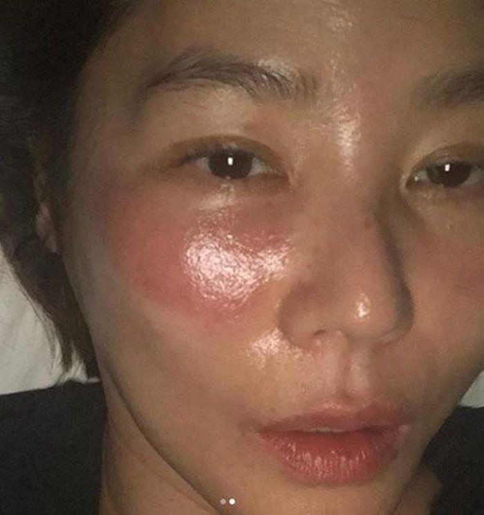 Sự cố làm đẹp của sao Việt: Hồ Quỳnh Hương hối hận khi xài kem trộn