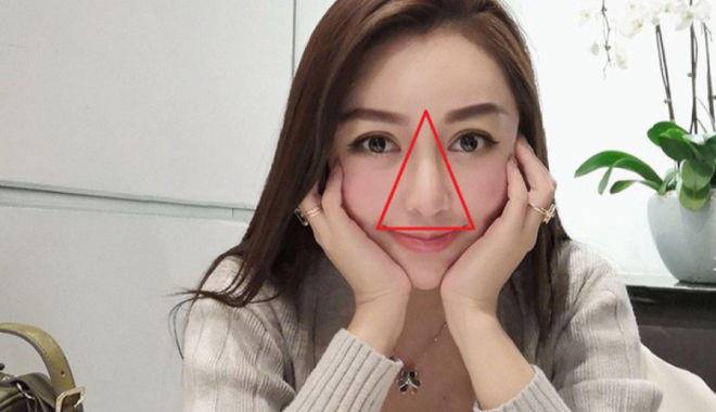 Bác sĩ Nguyễn Đức Long: Không được nặn mụn vùng tam giác tử thần