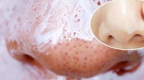 Công dụng thần kì của bàn chải đánh răng: trị mụn đầu đen, nhuộm tóc
