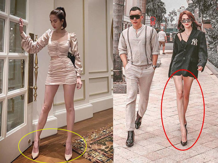 Ngọc Trinh để lộ đôi chân toàn vết thương, bầm tím