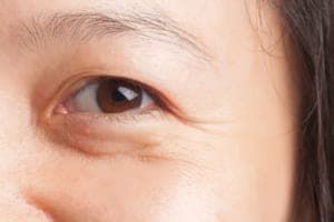 Ngừa lão hóa theo lời chuyên gia: Chú ý chỉ số SPF trên kem chống nắng