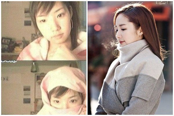 Vượt mặt Park Min Young, Hiền Hồ trở thành “đệ nhất mỹ nhân dao kéo”