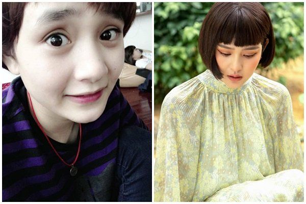 Vượt mặt Park Min Young, Hiền Hồ trở thành “đệ nhất mỹ nhân dao kéo”