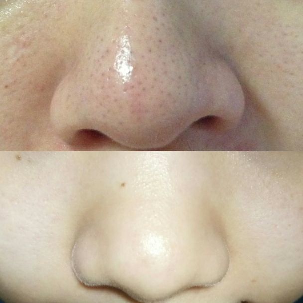 3 Công dụng tuyệt vời, hiệu quả của muối trong việc làm đẹp