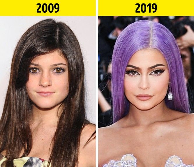 Hình ảnh tỷ phú thuở hàn vi: Kylie Jenner môi mỏng, Lucas phong trần