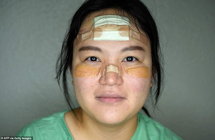 Khuôn mặt đầy vết băng dán của các y bác sĩ chống dịch gây xúc động