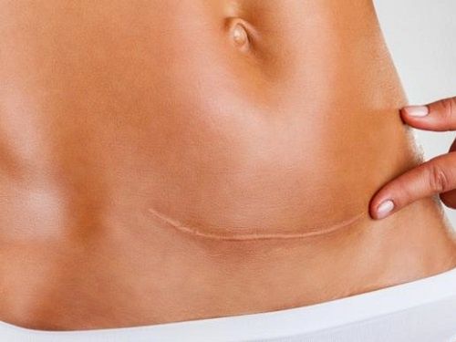 Ngưỡng mộ sản phụ thong thả bước ra từ phòng mổ như chưa hề vượt cạn
