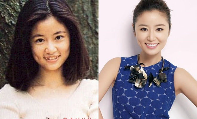 Trịnh Sảng, Angelababy và loạt sao Hoa ngữ đổi đời nhờ chỉnh răng