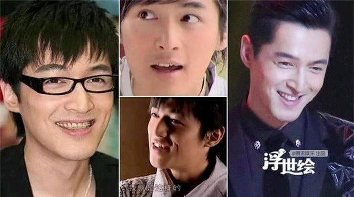 Trịnh Sảng, Angelababy và loạt sao Hoa ngữ đổi đời nhờ chỉnh răng
