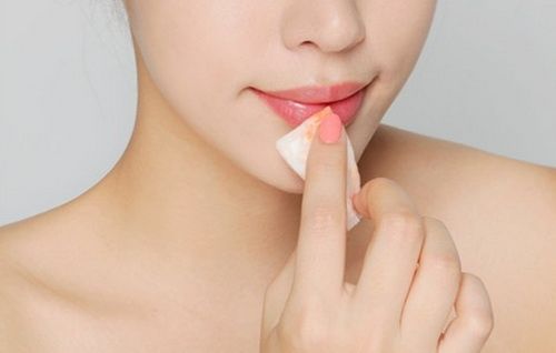 Cách trị thâm môi hiệu quả lại không tốn tiền ngay tại nhà