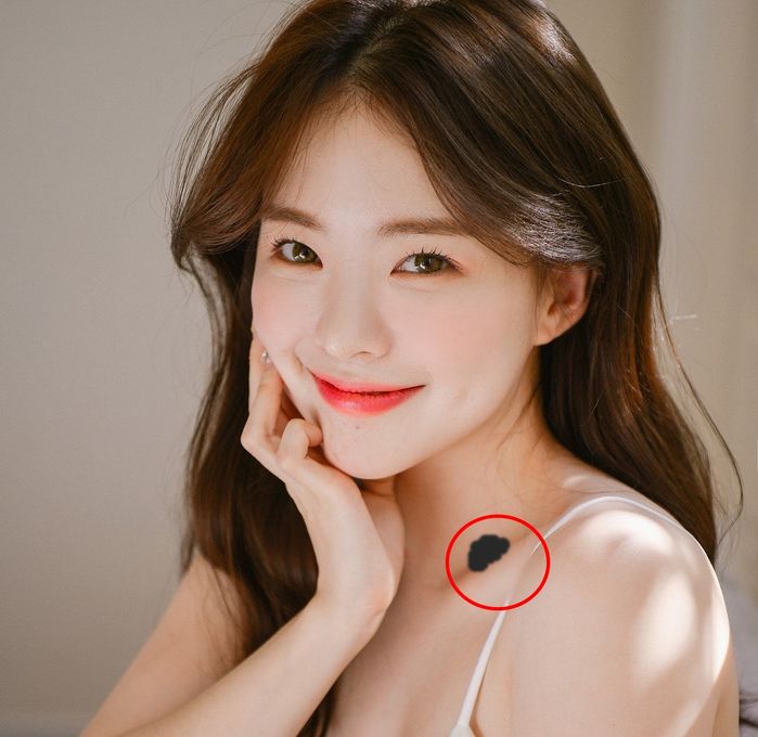 Ý nghĩa của các vết bớt: Ở mông là tốt số, ở chân xui rủi liên miên