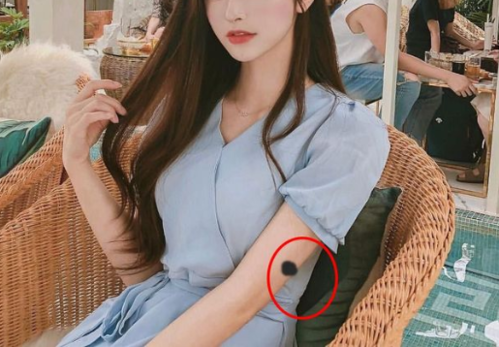 Ý nghĩa của các vết bớt: Ở mông là tốt số, ở chân xui rủi liên miên