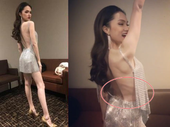 Mỹ nhân Việt xuống sắc vì quá gầy