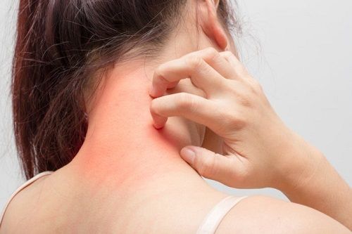 Sai lầm khi dùng kem chống nắng khiến da ngày càng xuống sắc