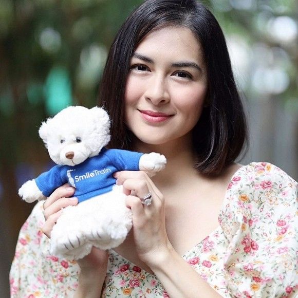 Mỹ nhân đẹp nhất Philippines lộ vẻ xuống sắc: Đầu hói, ngực xập xệ