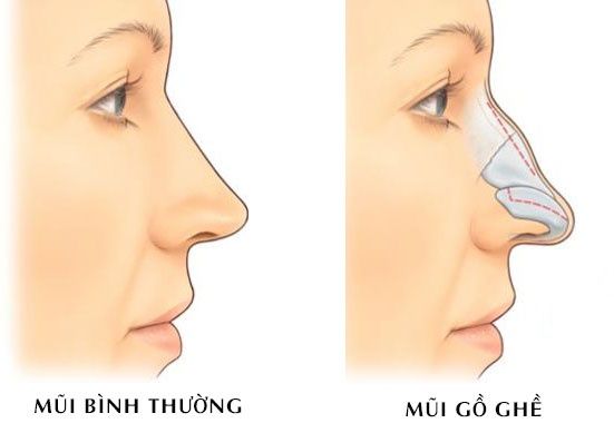 Nhân tướng học: Tướng phụ nữ có đường tình duyên lận đận