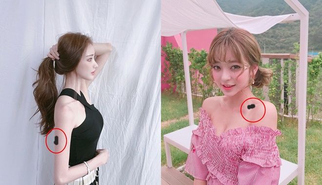 Ý nghĩa của các vết bớt: Ở mông là tốt số, ở chân xui rủi liên miên