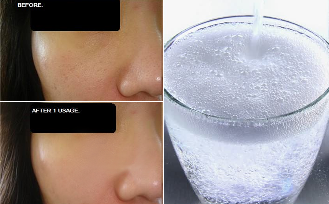 Cách làm đẹp với nước khoáng có gas