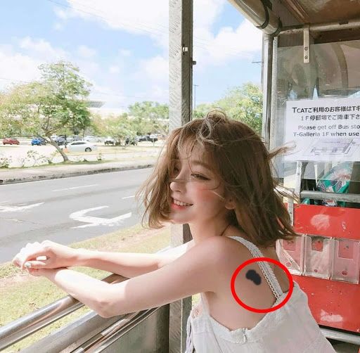 Ý nghĩa của các vết bớt: Ở mông là tốt số, ở chân xui rủi liên miên