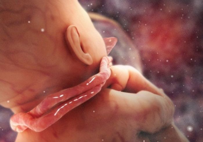Giải cứu thành công em bé bị dây rốn quấn 6 vòng quanh cơ thể
