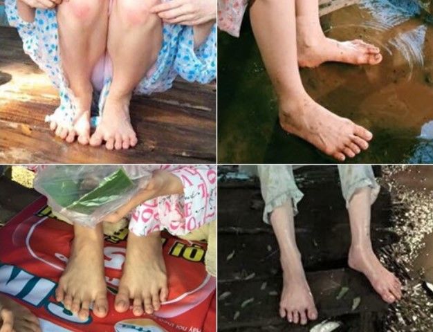 6 khuyết điểm cơ thể mà Ngọc Trinh có đắp tiền núi cũng khó thẩm mỹ