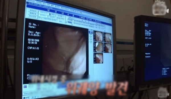 Bà cụ 74 tuổi uống nước ngọt liên tục 40 năm vì lý do hết sức đau lòng