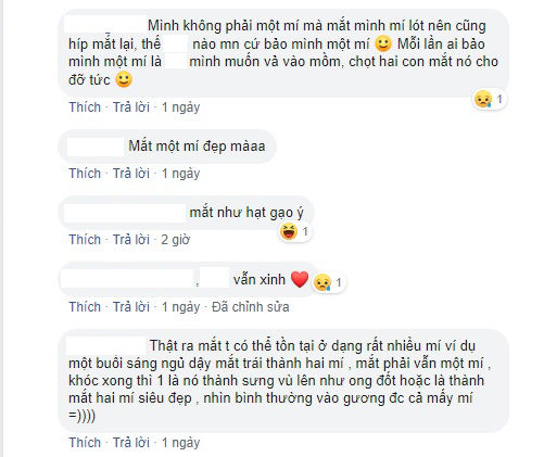 Nỗi khổ hội mắt một mí: Bị trêu ghẹo vì cười không thấy mặt trời