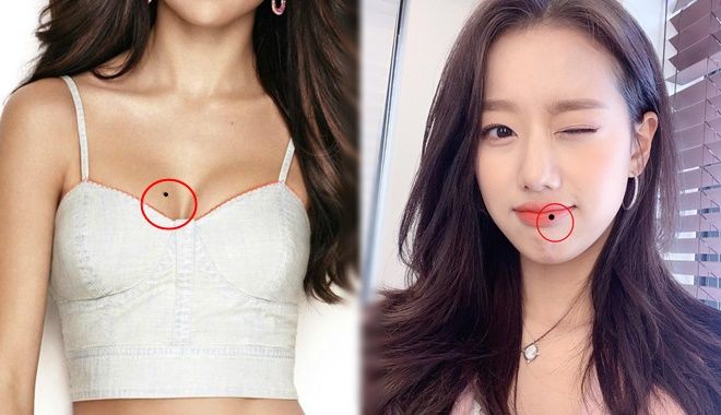 Có nốt ruồi ở môi, lòng bàn tay…chớ tẩy xóa kẻo đánh mất cả vận may