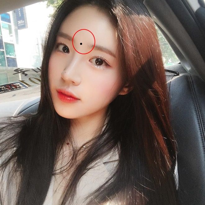 Có nốt ruồi ở môi, lòng bàn tay…chớ tẩy xóa kẻo đánh mất cả vận may