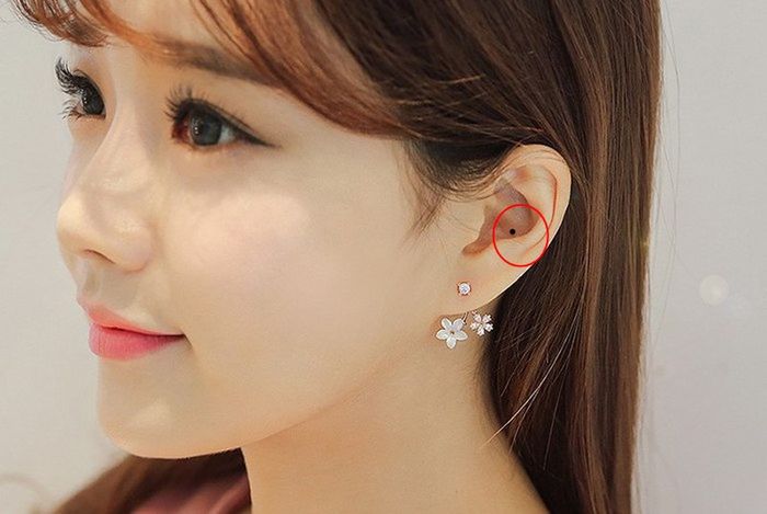Có nốt ruồi ở môi, lòng bàn tay…chớ tẩy xóa kẻo đánh mất cả vận may